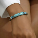 Alice | Tillsammans mot diabetes | Armband